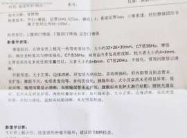 麻烦推荐上海肿瘤医院做肾脏手术的医生