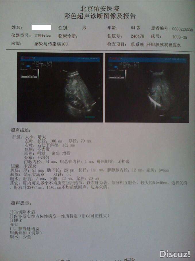B超 6月.jpg