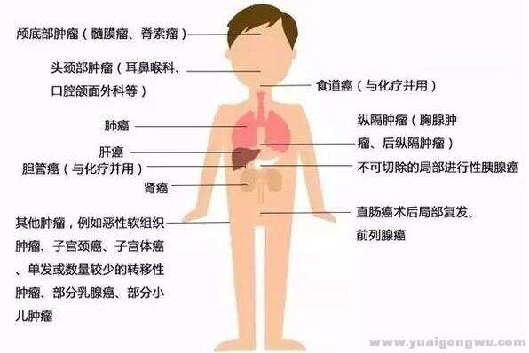 图四质子治疗适应症