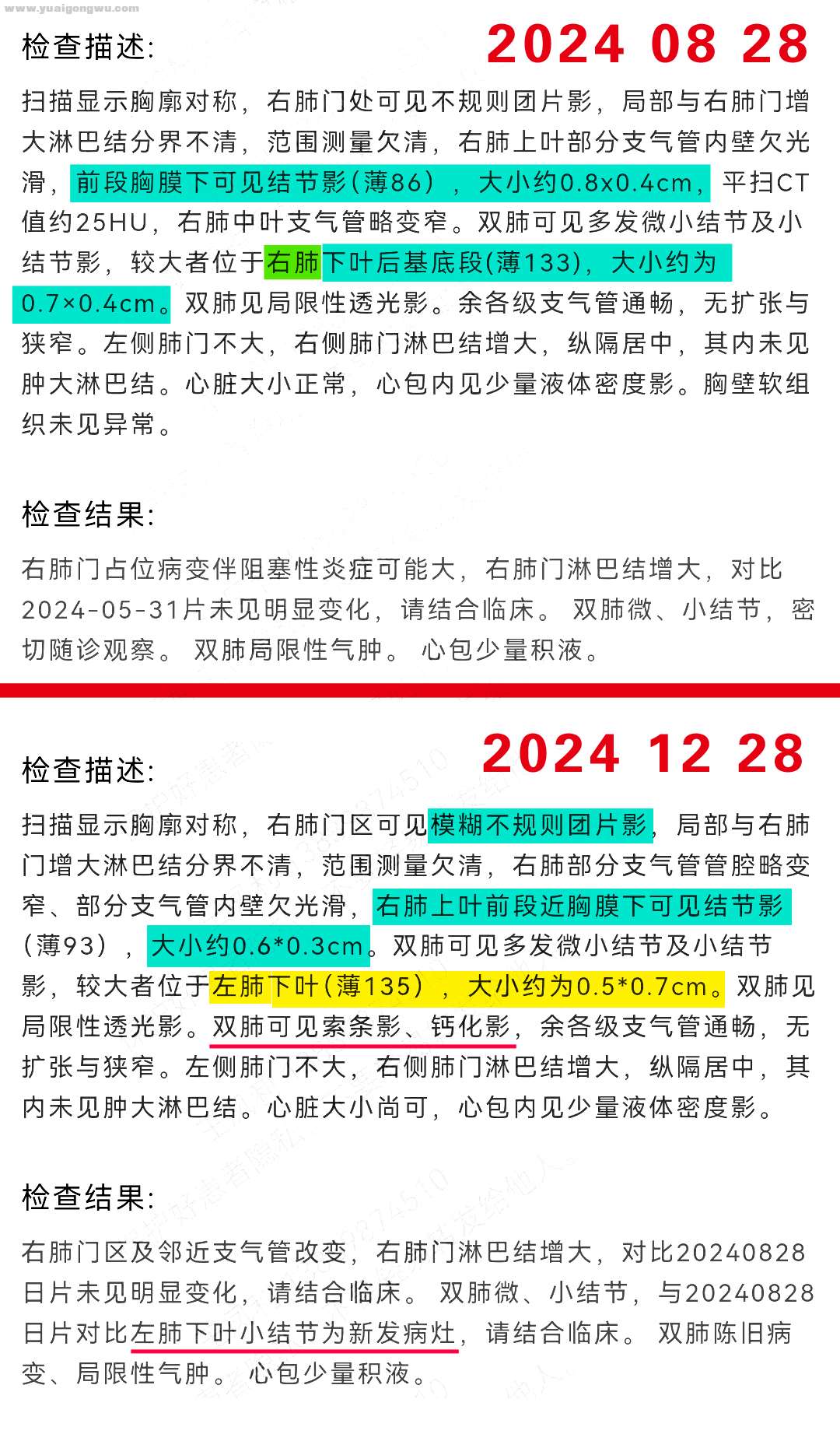 2023.8.29，穿刺取得病理，肺腺癌，2023.9.5，基因检测结果，ALK融合突变。2023.